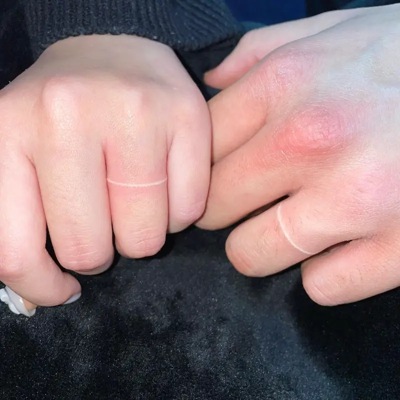 Invisible White Ink Wedding Ring Tattoo